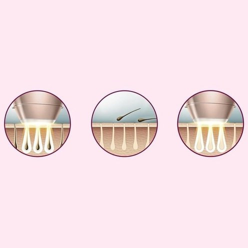 لیزر IPL فیلیپس اورجینال همراه باسری اضافه و موزن گوش و بینی و ابرو Philips Lume مدل bri955